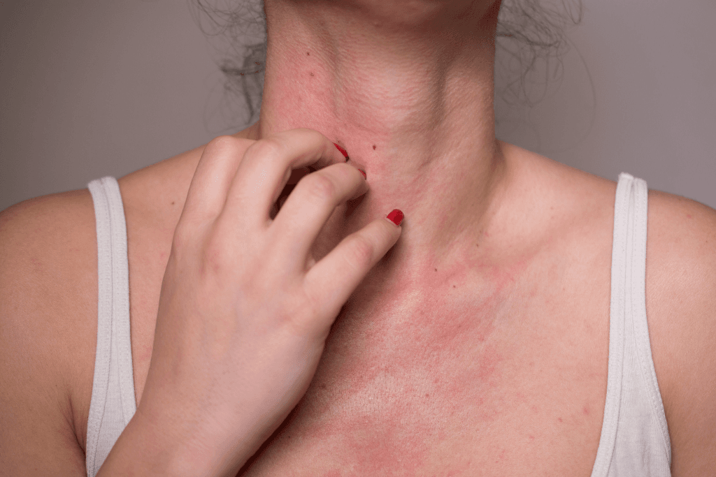 Uwaga! Alergia! Jak radzić sobie z uczuleniem u dentysty.